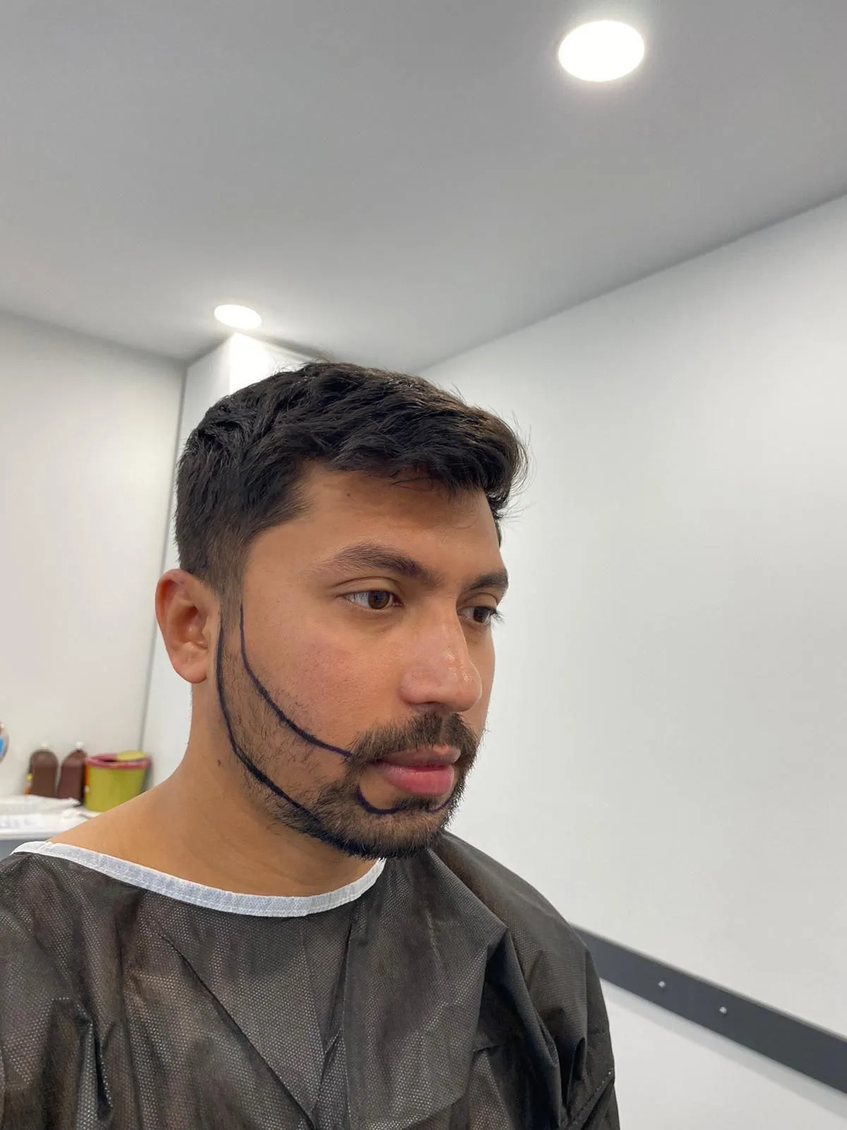 Beard & moustache — Before
