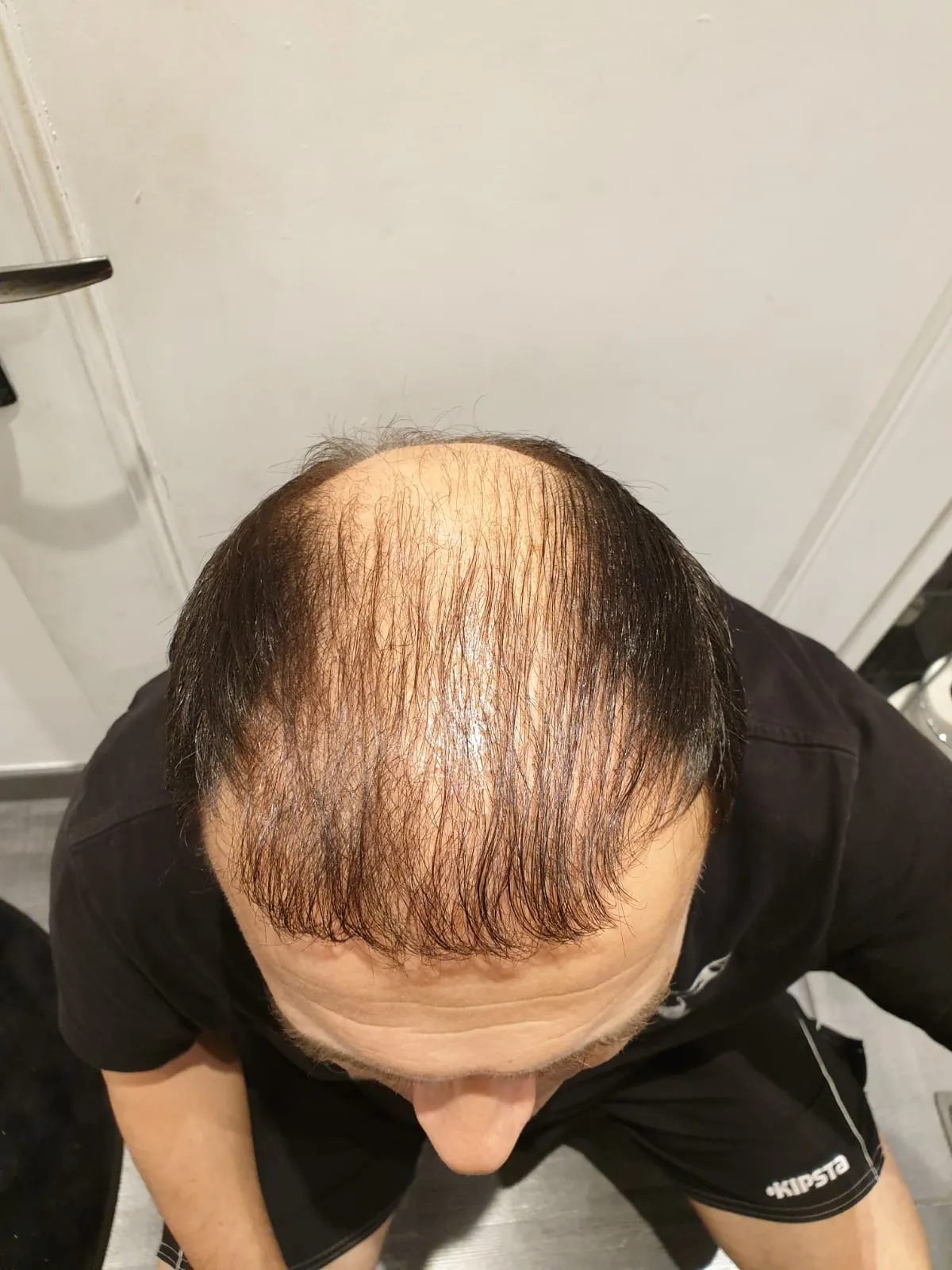 DHI — Before