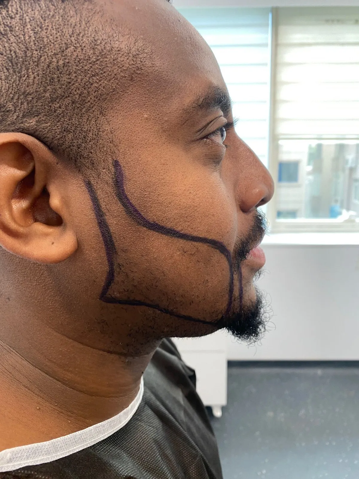 Beard & moustache — Before
